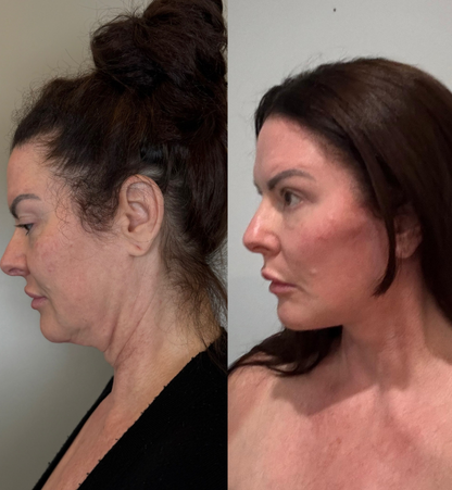 Jennifer Before After 1