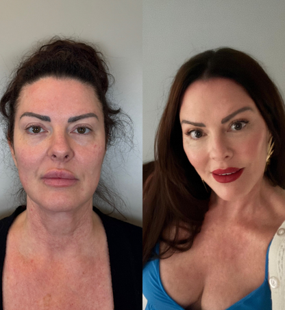 Jennifer Before After 3