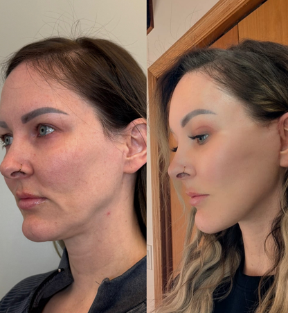 Joanne Before After 1