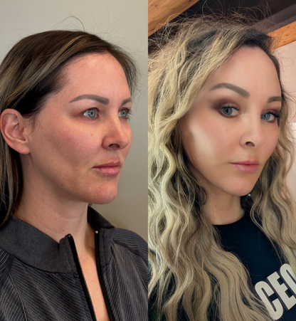 Joanne Before After 2