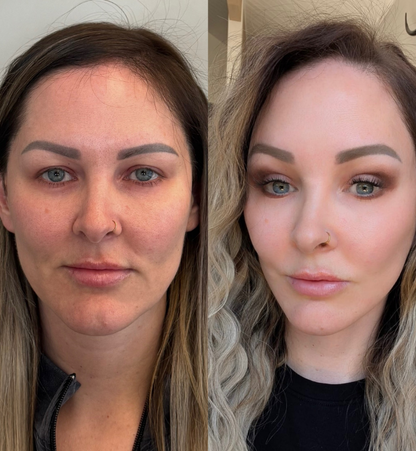 Joanne Before After 3